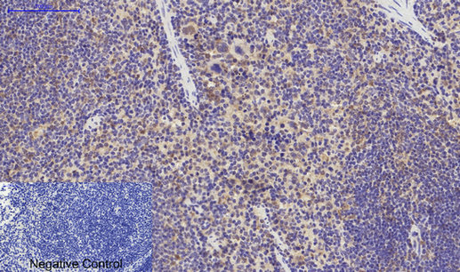 IHC - p38 Polyclonal Antibody AP71696